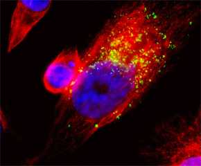 Líneas celulares procedentes de cáncer de mama. En azul se marcan los núcleos celulares, en rojo los microtúbulos y en verde las vesículas autofágicas.