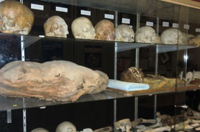 Algunas de las muestras de cráneos estudiadas, pertenecientes al departamento de Medicina Legal, Toxicología y Antropología Física de la Universidad de Granada.
