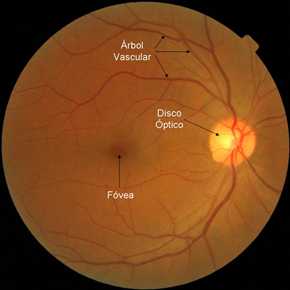Zonas anatómicas de la retina.