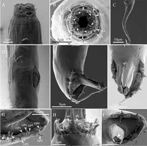 Imágenes de microscopía electrónica de barrido de Diploscapteroides persicus, las primeras de este género / Ghaemi et al.