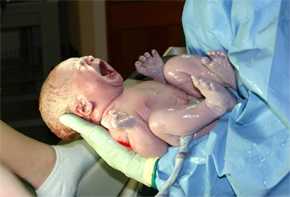 Una niña recién nacida, justo después del parto. (FOTO: Di Ernest F – WIKIMEDIA)