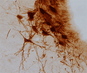 Neuronas de Locus Coeruleus