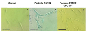 Fibroblastos control y derivados de pacientes con mutaciones en PANK2 sin tratar y tratados con UPO-001