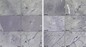 Microfotografías de la corteza cerebral de ratas no tratadas (izquierda) y tratadas con melatonina (derecha) en distintos momentos tras el ictus (antes, en el momento y dos horas después)