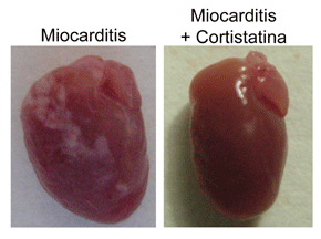 Corazón de un ratón con miocarditis sin tratamiento (izquierda), mostrando signos de hipertrofia cardiaca, depósitos de calcio y fibrosis pericárdica previos a una cardiomiopatía dilatada. Corazón de un ratón con miocarditis tratado con cortistatina (derecha) donde se ve que todos estos signos se previenen