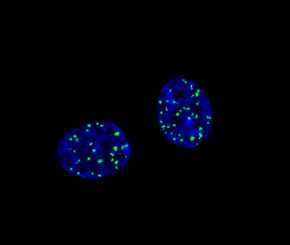 Roturas del ADN (puntos verdes) en el núcleo de células tratadas con un agente de quimioterapia./F.C