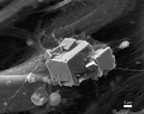 'Hueso artificial', o mineralización de la matriz extracelular obtenida por los científicos granadinos gracias a su patente.